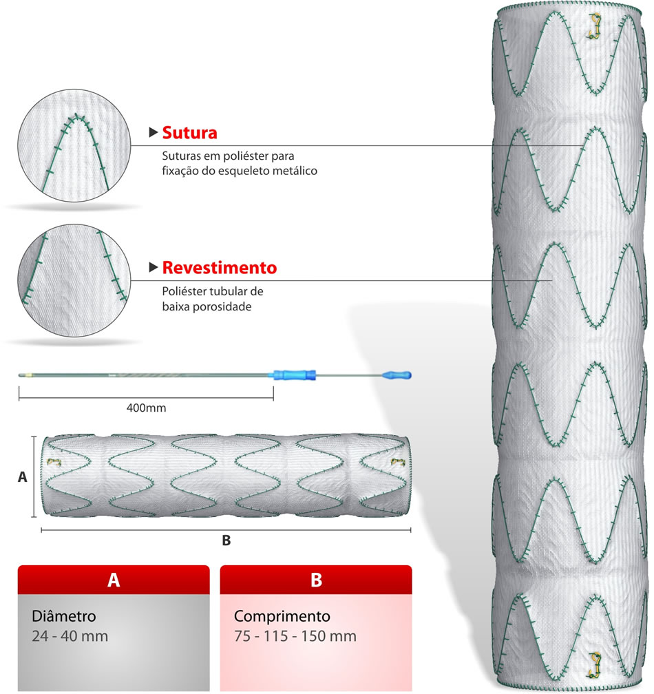aortic stent grafts